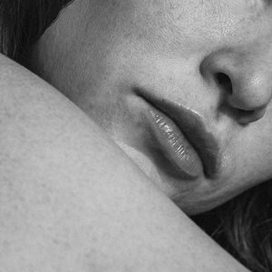 Pigment + Discolouration