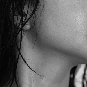 Redness + Sensitivity